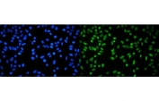 Immunofluorescent staining of FFPE human HeLa cells with RPA32 antibody (green) and DAPI nuclear stain (blue). HIER: steam section in pH6 citrate buffer for 20 min.
