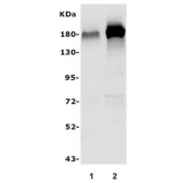 Western blot testing of human 1) U-87 MG and 2) SH-SY5Y lysate with Nogo A antibody. Predicted molecular weight ~130 kDa but may be observed at up to ~220 kDa.