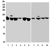 Western blot testing of human 1) HEK293, 2) HeLa, 3) Raji, 4) U-2 OS, 5) Jurkat, 6) Caco-2, 7) rat brain, 8) rat PC-12, 9) mouse brain and 10) mouse RAW264.7 with Semaphorin 6A antibody. Predicted molecular weight ~114 kDa.
