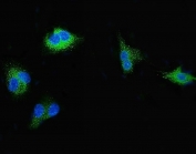 Immunofluorescent staining of FFPE human A549 cells with SGK1 antibody (green) and DAPI nuclear stain (blue). HIER: steam section in pH6 citrate buffer for 20 min.