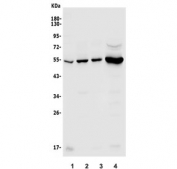 Western blot testing of human 1) placenta, 2) A431, 3) PANC-1 and 4) Jurkat lysate with SGK1 antibody. Expected molecular weight: 45-60 kDa.