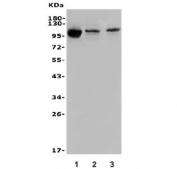 Western blot testing of human 1) Raji, 2) Jurkat and 3) A549 lysate with STAT6 antibody. Predicted molecular weight ~94 kDa.