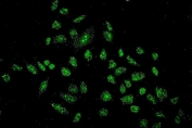 Immunofluorescent staining of FFPE human A549 cells with GNB1 antibody. HIER: steam section in pH6 citrate buffer for 20 min.