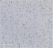 IHC staining of FFPE mouse brain with Transketolase antibody. HIER: boil tissue sections in pH8 EDTA for 20 min and allow to cool before testing.