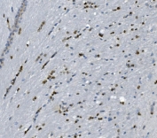IHC staining of FFPE rat brain with Transketolase antibody. HIER: boil tissue sections in pH8 EDTA for 20 min and allow to cool before testing.
