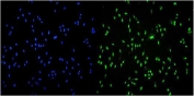 Immunofluorescent staining of FFPE human A549 cells with Transketolase antibody (green) and DAPI nuclear stain (blue). HIER: steam section in pH6 citrate buffer for 20 min.