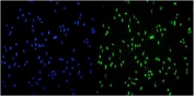 Immunofluorescent staining of FFPE human A549 cells with Transketolase antibody (green) and DAPI nuclear stain (blue). HIER: steam section in pH6 citrate buffer for 20 min.