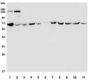 Western blot testing of human 1) A549, 2) HEK293, 3) placenta, 4) Jurkat, 5) HT1080, 6) HepG2, 7) SW620, 8) Raji, 9) rat liver, 10) rat RH35 and 11) mouse HEPA1-6 lysate with Transketolase antibody. Predicted molecular weight ~68 kDa.
