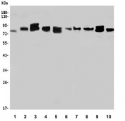 Western blot testing of human 1) A431, 2) ThP-1, 3) Raji, 4) K562, 5) U-2 OS, 6) SK-O-V3, 7) rat brain, 8) rat PC-12, 9) mouse thymus and 10) mouse SP2/0 lysate with WAC antibody. Expected molecular weight: 70-80 kDa.
