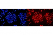 Immunofluorescent staining of FFPE human A431 cells with WAC antibody (red) and DAPI nuclear stain (blue). HIER: steam section in pH6 citrate buffer for 20 min.