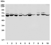 Western blot testing of human 1) HEK293, 2) HepG2, 3) Jurkat, 4) A549, 5) Raji, 6) SW620, 7) SK-O-V3, 8) rat PC-12, 9) mouse Neuro-2a and 10) mouse ANA-1 lysate with WNT2B antibody. Predicted molecular weight ~44 kDa, comonly observed at 44-60 kDa.