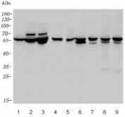 Western blot testing of human 1) U-87 MG, 2) SH-SY5Y, 3) SW620, 4) Raji, 5) rat brain, 6) rat heart, 7) rat C6, 8) mouse brain and 9) mouse Neuro-2a lysate with WNT8A antibody. Predicted molecular weight ~39 kda, commonly observed at 39-60 kDa.