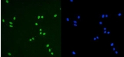 Immunofluorescent staining of FFPE human U-2 OS cells with TRIM28 antibody (green) and DAPI nuclear stain (blue). HIER: steam section in pH6 citrate buffer for 20 min.