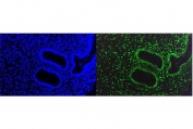 Immunofluorescent staining of FFPE human breast cancer cells with TRIM28 antibody (green) and DAPI nuclear stain (blue). HIER: steam section in pH8 EDTA for 20 min.