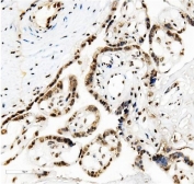 IHC staining of frozen human placenta with TRIM28 antibody.