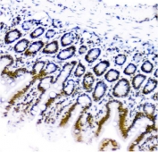 IHC staining of FFPE mouse small intestine with TRIM28 antibody. HIER: boil tissue sections in pH8 EDTA for 20 min and allow to cool before testing.