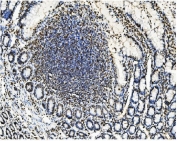 IHC staining of FFPE rat intestine with TRIM28 antibody. HIER: boil tissue sections in pH8 EDTA for 20 min and allow to cool before testing.