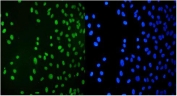 Immunofluorescent staining of FFPE human U-2 OS cells with TRIM28 antibody (green) and DAPI nuclear stain (blue). HIER: steam section in pH6 citrate buffer for 20 min.