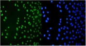 Immunofluorescent staining of FFPE human U-2 OS cells with TRIM28 antibody (green) and DAPI nuclear stain (blue). HIER: steam section in pH6 citrate buffer for 20 min.