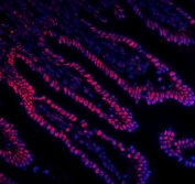 Immunofluorescent staining of FFPE mouse intestine with DDX5 antibody (red) and DAPI nuclear stain (blue). HIER: steam section in pH8 EDTA for 20 min.