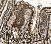 IHC staining of FFPE rat intestine with DDX5 antibody. HIER: boil tissue sections in pH8 EDTA for 20 min and allow to cool before testing.