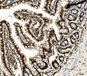 IHC staining of FFPE rat intestine with DDX5 antibody. HIER: boil tissue sections in pH8 EDTA for 20 min and allow to cool before testing.