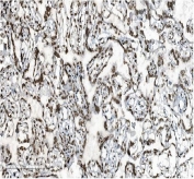 IHC staining of frozen human placenta with DDX5 antibody.