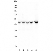 Western blot testing of human 1) HeLa, 2) HEK293, 3) Jurkat, 4) A549 and 5) U-87 MG antibody. Expected molecular weight ~50 kDa.