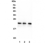 Western blot testing of 1) human HeLa, 2) human T-47D and 3) rat RH35 lysate with HSP22 antibody. Expected molecular weight: 22-27 kDa.