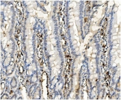 IHC staining of FFPE rat intestine with BubR1 antibody. HIER: boil tissue sections in pH8 EDTA for 20 min and allow to cool before testing.