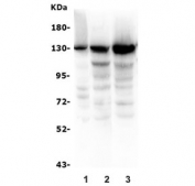 Western blot testing of human 1) HeLa, 2) HEK293 and 3) K562 lysate with BubR1 antibody. Predicted molecular weight ~120 kDa.
