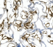 IHC staining of frozen human placenta with PECAM1 antibody.