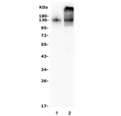 Western blot testing of human 1) Jurkat and 2) placenta lysate with PECAM1 antibody. Expected molecular weight: 83-130 kDa depending on level of glycosylation.