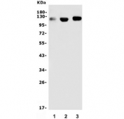 Western blot testing of human 1) placenta, 2) A375 and 3) HeLa lysate with CD146 antibody. Observed molecular weight 70-120 kDa depending on glycosylation level.