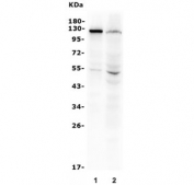 Western blot testing of human 1) A431 and 2) Caco-2 lysate with CDH3 antibody. Expected molecular weight: ~91 kDa (unmodified), 100~130 kDa (glycosylated).