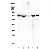 Western blot testing of 1) human Jurkat, 2) human CCRF-CEM, 3) rat thymus, 4) mouse spleen and 5) mouse thymus lysate with ZAP70 antibody. Expected molecular weight ~70 kDa.