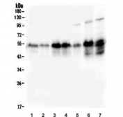 Western blot testing of human 1) HeLa, 2) A549, 3) HepG2, 4) Caco-2, 5) HL-60, 6) rat liver and 7) mouse liver lysate with Retinoid X Receptor alpha antibody. Predicted molecular weight: ~51 kDa but routinely observed at 54~60 kDa.
