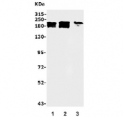 Western blot testing of human 1) HeLa, 2) ThP-1 and 3) U-87 MG lysate with BRM antibody. Predicted molecular weight ~181 kDa.