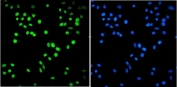 Immunofluorescent staining of FFPE human A549 cells with BRM antibody (green) and DAPI nuclear stain (blue). HIER: steam section in pH6 citrate buffer for 20 min.