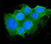 Immunofluorescent staining of FFPE human MCF7 cells with Bid antibody (green) and DAPI nuclear stain (blue). HIER: steam section in pH6 citrate buffer for 20 min.