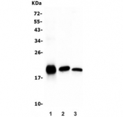 Western blot testing of human 1) Jurkat, 2) A549 and 3) HEK293 lysate with Bid antibody. Predicted molecular weight ~22 kDa.