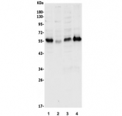 Western blot testing of human 1) Jurkat, 2) HeLa, 3) SW620 and 4) Caco-2 lysate with CDKN1C antibody. Expected molecular weight ~57 kDa.