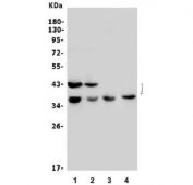 Western blot testing of 1) rat brain, 2) mouse brain, 3) human U-87 MG and 4) mouse Neuro-2a lysate with GAP43 antibody. Predicted molecular weight ~43 kDa with possible 38 kDa band (Ref 1).