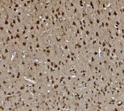 IHC staining of FFPE rat brain with GAP43 antibody. HIER: boil tissue sections in pH8 EDTA for 20 min and allow to cool before testing.