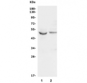 Western blot testing of human 1) K562 and 2) HeLa lysate with GSK3A antibody. Predicted molecular weight ~51 kDa.