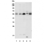 Western blot testing of human 1) HeLa, 2) HepG2, 3) HEK293, 4) rat liver and 5) mouse lung lysate with SMAD5 antibody. Expected molecular weight: 52~60 kDa.