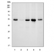 Western blot testing of human 1) HeLa, 2) HepG2, 3) HEK293, 4) rat liver and 5) mouse lung lysate with SMAD5 antibody. Expected molecular weight: 52~60 kDa.