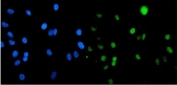 Immunofluorescent staining of FFPE human A549 cells with SMAD5 antibody (green) and DAPI nuclear stain (blue). HIER: steam section in pH6 citrate buffer for 20 min.