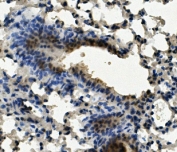 IHC staining of FFPE mouse lung with AHR antibody. HIER: boil tissue sections in pH8 EDTA for 20 min and allow to cool before testing.