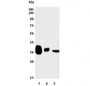 Western blot testing of 1) rat liver, 2) mouse liver and 3) human Caco-2 lysate with AKR1D1 antibody. Predicted molecular weight ~37 kDa.